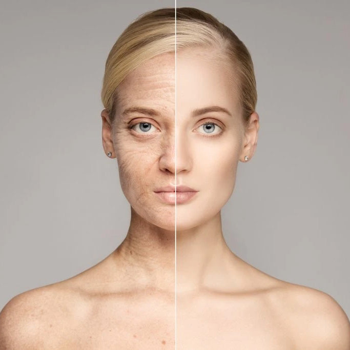 Combating Aging Skin